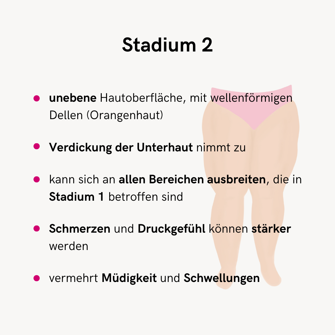 Bei Lipödem Stadien werden vor allem drei Lipödem Stadien genannt, diese unterscheiden sich in den Lipödem Symptomen.  